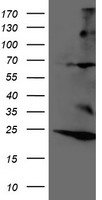 IBRDC2 Antibody