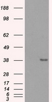 SORD Antibody