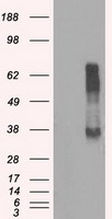 RNF144B Antibody