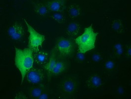 BUB1B Antibody