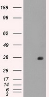 FCGR2A Antibody