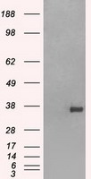 FCGR2A Antibody