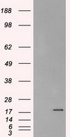 Alpha B Crystallin Antibody