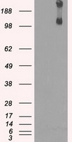 KDM4C Antibody