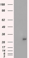 Protein kinase Y linked Antibody
