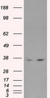 LDHA Antibody