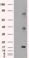 CTAG1B Antibody