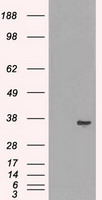 LDHA Antibody