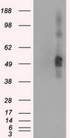 CD4 Antibody