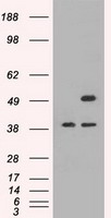 CD4 Antibody
