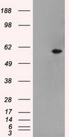 MADM Antibody