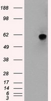 MADM Antibody