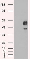 SSB Antibody