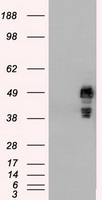 SSB Antibody
