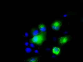 Melanoma gp100 Antibody
