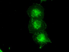 TYRO3 Antibody