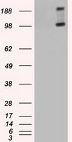 TRPM4 Antibody