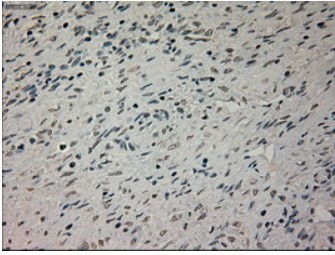 GFAP Antibody