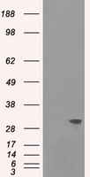 Cardiac Troponin I Antibody