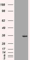 CDX2 Antibody