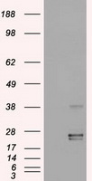 OSM Antibody