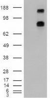 PTCH1 Antibody