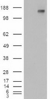 PTCH1 Antibody
