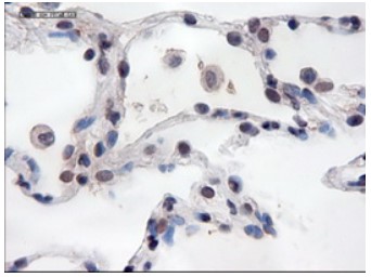 PECAM1 Antibody
