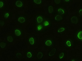 GSC Antibody