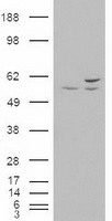 AKT3 Antibody