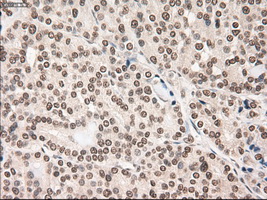 NOTCH1 Antibody