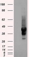 alpha 1 Antitrypsin (SERPINA1) Mouse Monoclonal Antibody [Clone ID: OTI3C5]