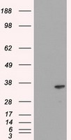 DFFA Antibody