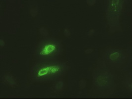 EPCAM Antibody