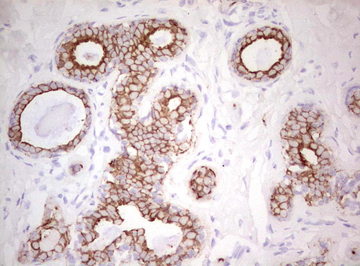 Basic Cytokeratin Antibody