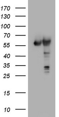 PKM2 Antibody