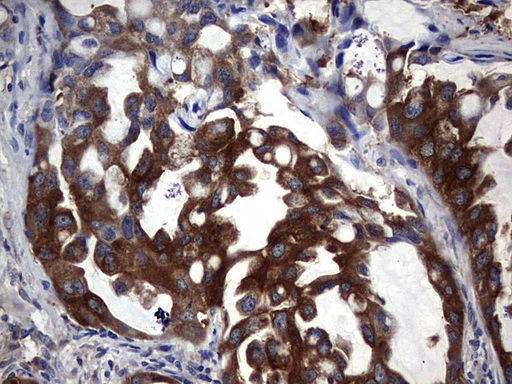 PKM2 Antibody