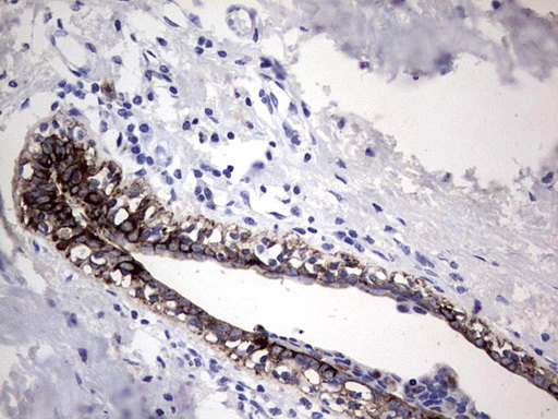 Acidic CK Antibody