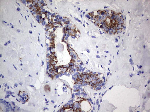 Acidic CK Antibody