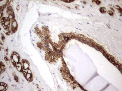 Acidic CK Antibody