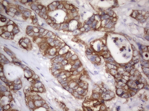 Acidic CK Antibody