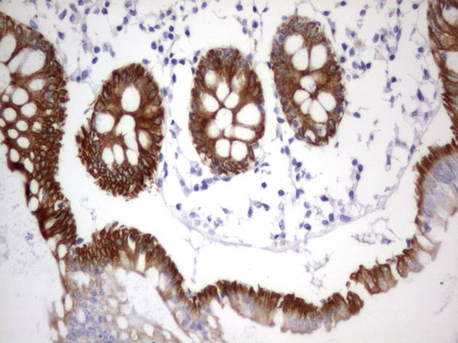Acidic CK Antibody