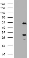 Timer Antibody