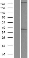 AKR1D1 Human Over-expression Lysate