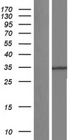 HYI Human Over-expression Lysate