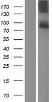 SUN1 Human Over-expression Lysate