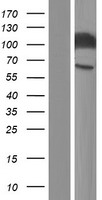 CEACAM1 Human Over-expression Lysate