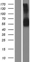 GM CSF Receptor alpha (CSF2RA) Human Over-expression Lysate