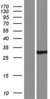 DDHD2 Human Over-expression Lysate