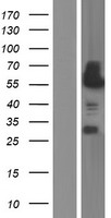 CAMK2D Human Over-expression Lysate